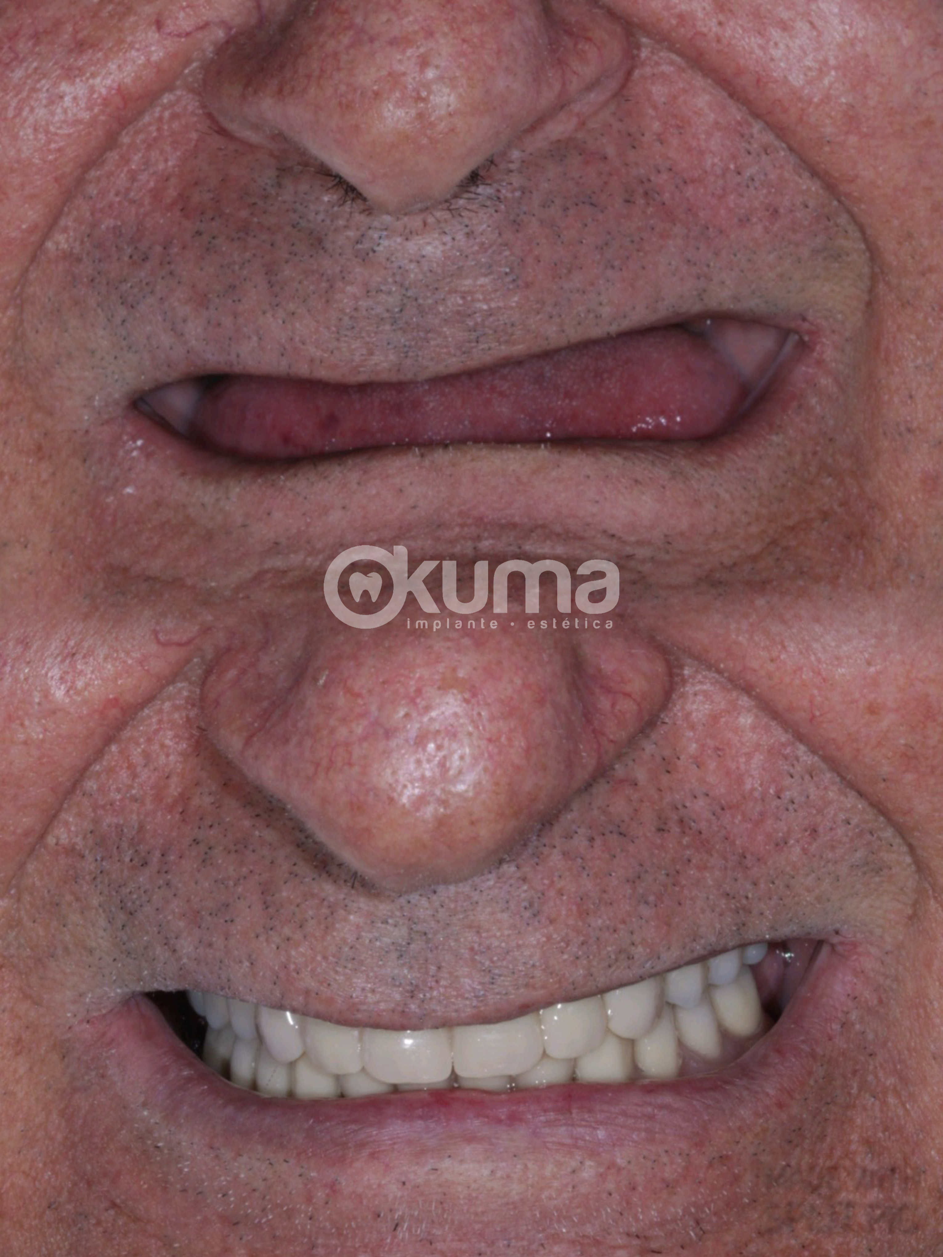 {"tiktok_developers_3p_anchor_params":"{"source_type":"vicut","picture_template_id":"","client_key":"aw889s25wozf8s7e","capability_name":"retouch_edit_tool"}","data":{},"editType":"image_edit","source_type":"vicut","pictureId":"4C4CC4EF-AC72-439F-9D5C-8CE3D011A9BF","exportType":"image_export"}