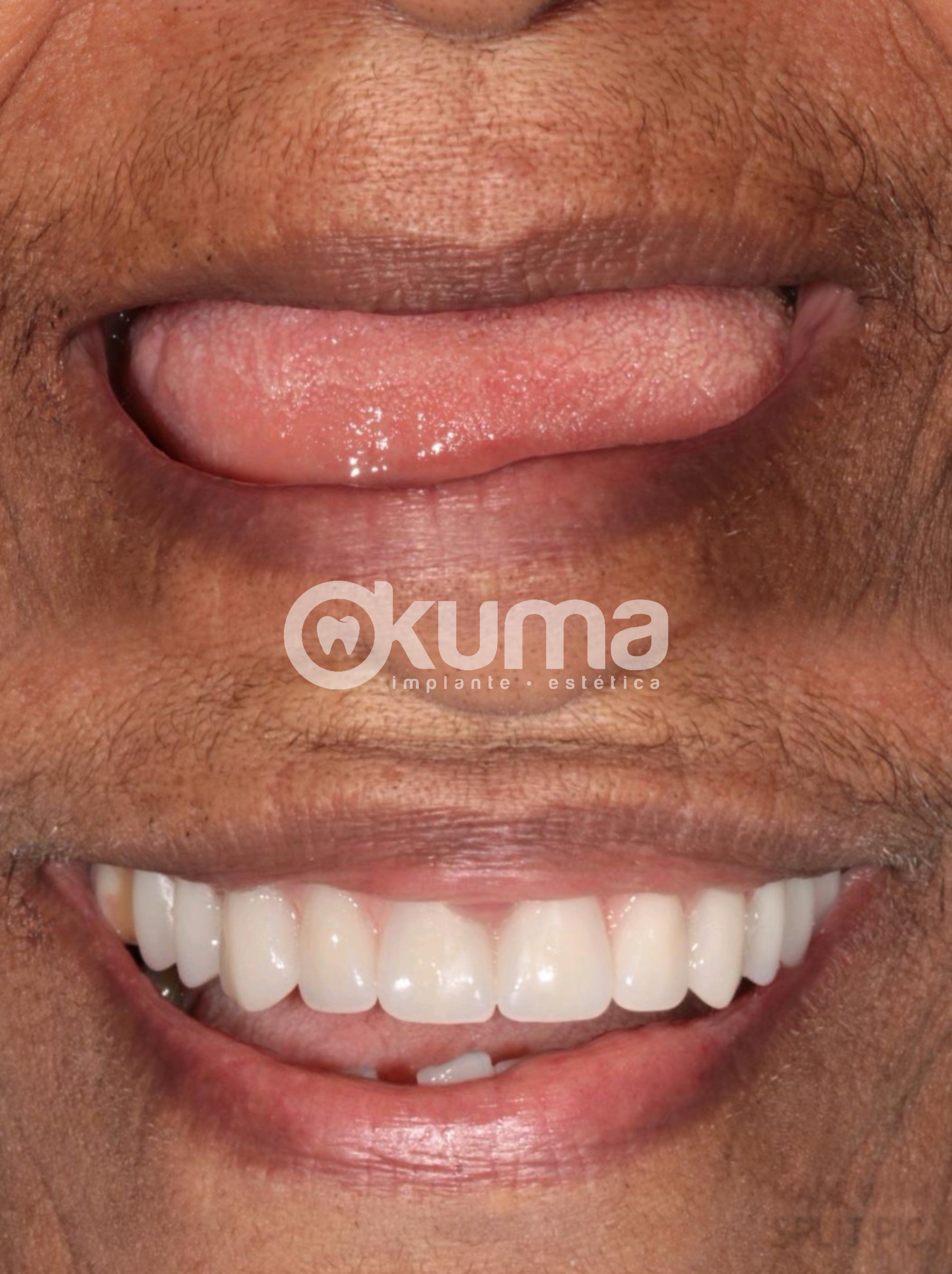 {"pictureId":"118F20D5-686C-41FC-9A36-45BEA782997A","tiktok_developers_3p_anchor_params":"{"capability_name":"retouch_edit_tool","picture_template_id":"","client_key":"aw889s25wozf8s7e","source_type":"vicut"}","editType":"image_edit","data":{},"source_type":"vicut","exportType":"image_export"}